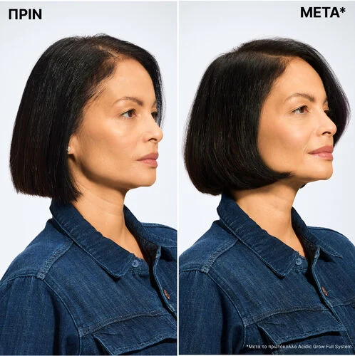 Acidic Grow Full System Serum Αναζωογόνησης & Ενυδάτωσης 100ml - Image 4